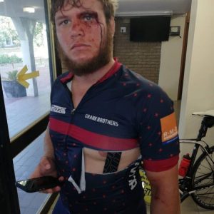 Cyclists are “defenceless” against thuggish attacks - Two cyclists were severely injured when they were attacked by a vindictive group of people in Stellenbosch